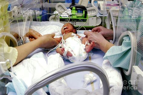 Jaundiced Premature Baby Photograph By Aj Photoscience Photo Library