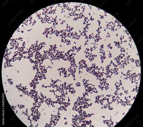 Smear Of Gram Positive Cocci Bacteria Under 100x Light Microscope 스톡