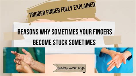 Why Do Your Fingers Become Stuck Sometimes Trigger Finger Explained