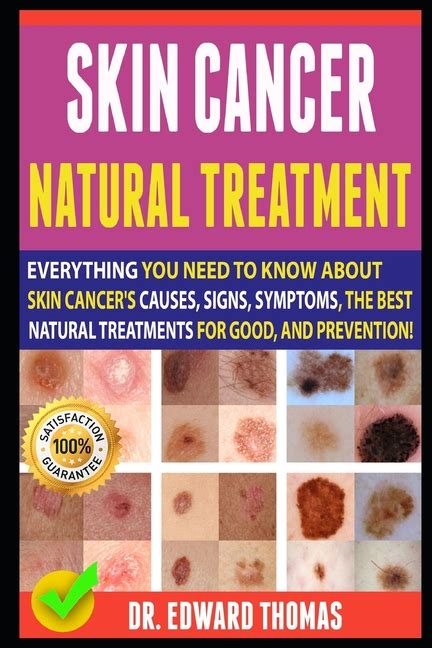 Skin Cancer Natural Treatment Everything You Need To Know About Skin