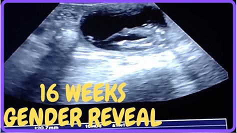 16 Weeks Gender Reveal Ultrasound Youtube