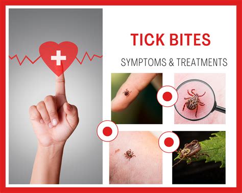 Tick Bites Symptoms Treatment And Prevention