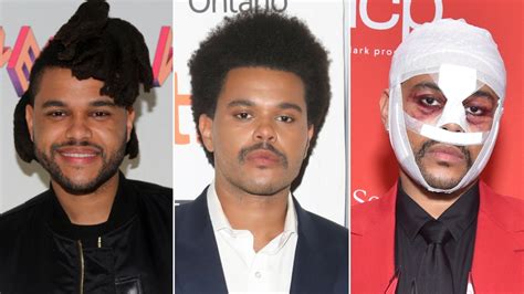 The Weeknd Transformation Music Videos Plastic Surgery And More