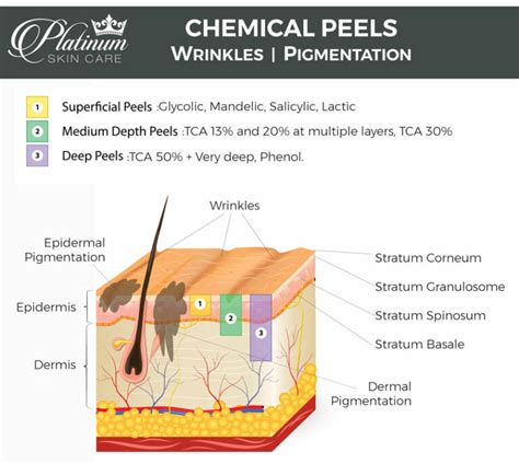 Learning Acids Peel University By Platinum Skin Care