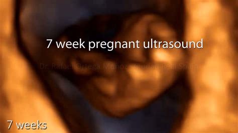 7 Week Pregnant Ultrasound Youtube