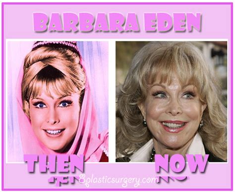 Barbara Eden ~ 100 Plastic Surgery