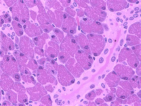 Pancreatic Acinar Cells