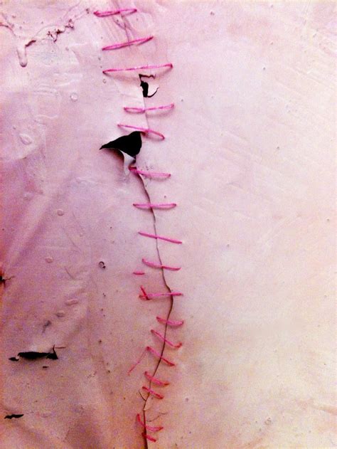 broken hymen reconstructed pink life