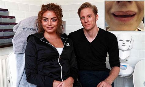 Model Is Left With Bizarre Lumpy Lips After Botched Job Daily Mail Online