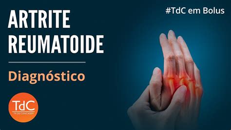 Diagnóstico De Artrite Reumatóide Tdc Em Bolus Youtube