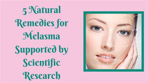 Pin On Melasma Cures