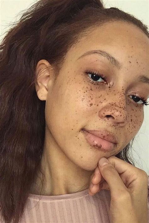 Beautiful Black Women Flaunting Their Freckles Essence