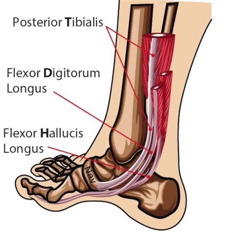 Got Flat Feet Posterior Tibialis Tendon Dysfunction Gen Physio
