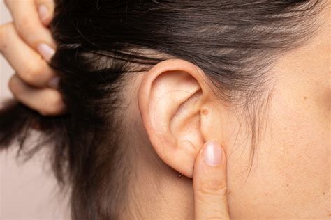 9 Best Home Remedies For Lump Behind Ear Symptoms And