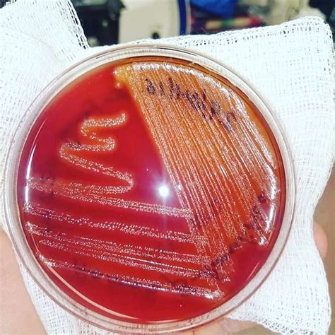 Doctordconline Streptococcus Pyogenes In Blood Agar Media Marithapress