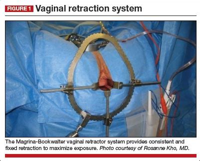 Transforming Vaginal Hysterectomy 7 Solutions To The Most Daunting