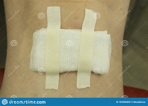 Hip Wound Sealed By White Adhesive Plaster Stock Photo Cartoondealer