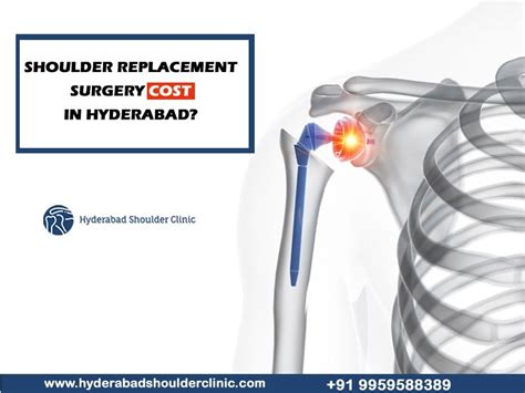 Shoulder Replacement Surgery Cost In Hyderabad Shoulder Clinic Hyderabad
