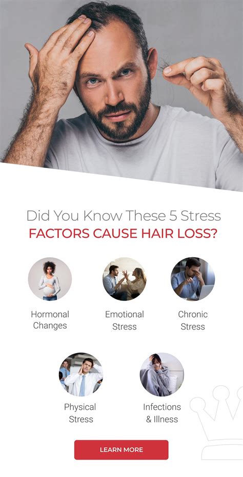 Ds Laboratories How Stress Affects Hair Loss Milled