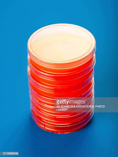 Blood Agar Plate Photos And Premium High Res Pictures Getty Images