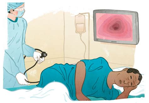 Colonoscopy What Its Like Before During And After Colonoscopy