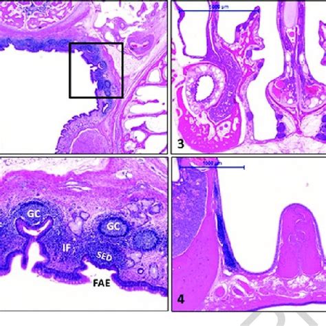 Pdf Mucosa Associated Lymphoid Tissues