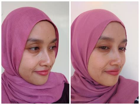 We stay for 2 months (wish it could be longer) every year. Erha Before After - Blog Kesehatan Anda
