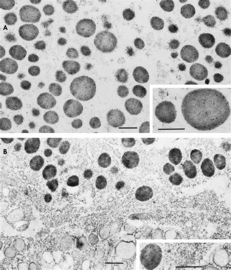 Transmission Electron Microscopy Images Of Immunogold Labeled Secretory