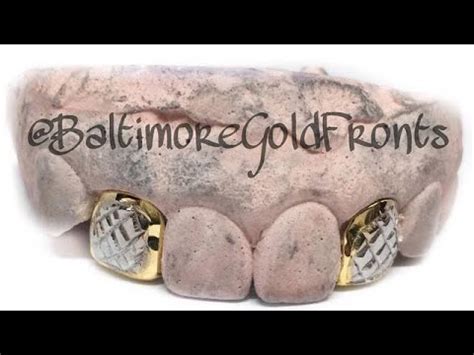 Check spelling or type a new query. Baltimore Gold Fronts #1 Place To Get Custom Gold Teeth ...