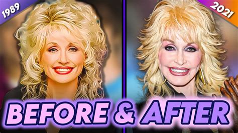 Dolly Parton Before After Her Transformation Over The Years Youtube