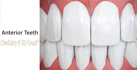 What Is Anterior Teeth Dentistry At Its Finest