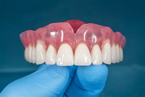New Dentures - Denture Wearers