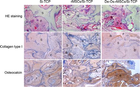 De Os RMSCs Formed More Ectopic Bone In Nude Mice The Untreated RMSCs