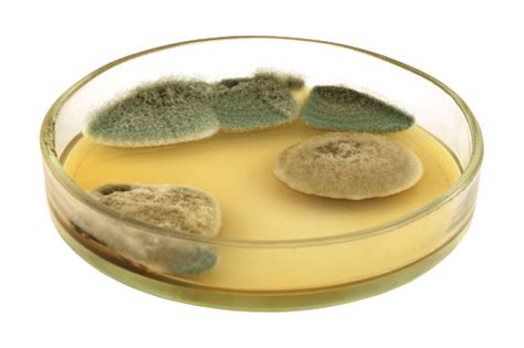 Different Puffy Fungal Colonies On Agar Plate Isolated Stock Photo