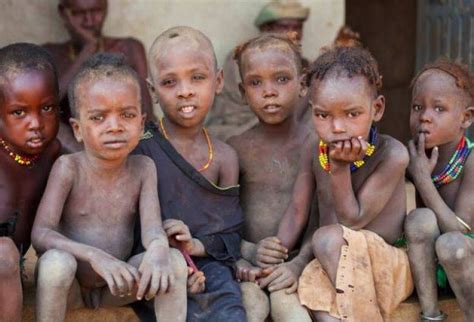 Etiópia Decide Proibir A Adoção Internacional De Crianças Portal O Norte