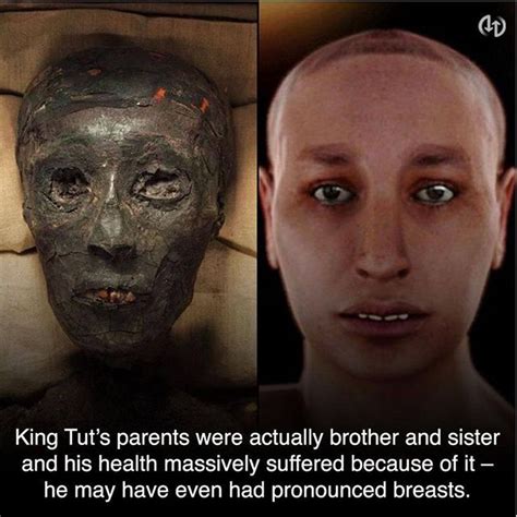 King Tuts Parents Were Brother And Sister So He Suffered From Many