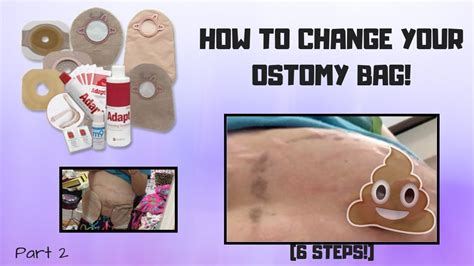 How To Change Your Ostomy Bag Part 2 Youtube