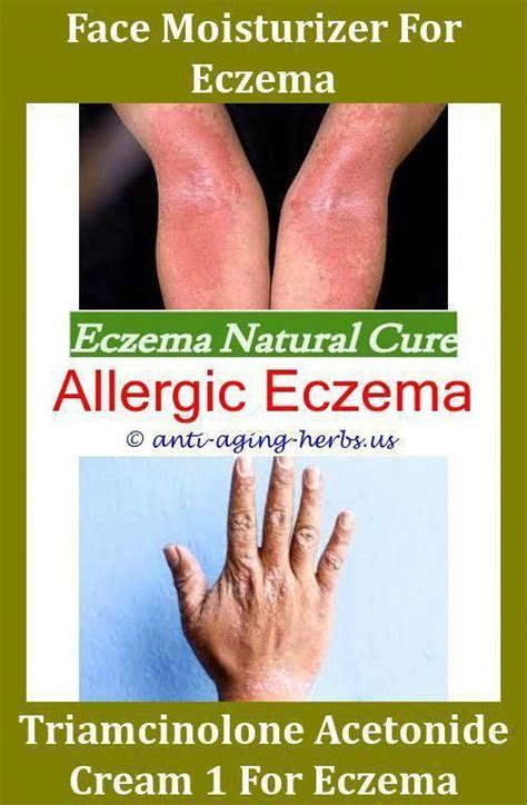What To Use For Eczema On Neck How To Relieve Eczema On Faceeczema