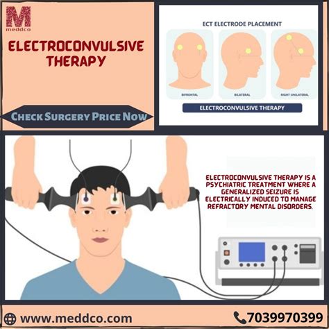 Electroconvulsive Therapy The Psychology Sage