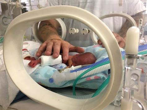 Premmie Baby Born At 23 Weeks Defies The Odds And Turns Seven Months