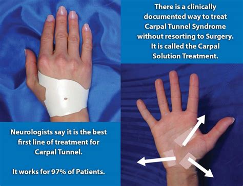 What Is The Risk Of Infection With Carpal Tunnel Surgery