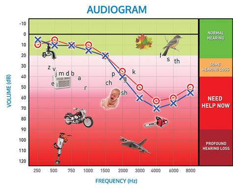 How To Read An Audiogram Hearclear Hearing Solutions