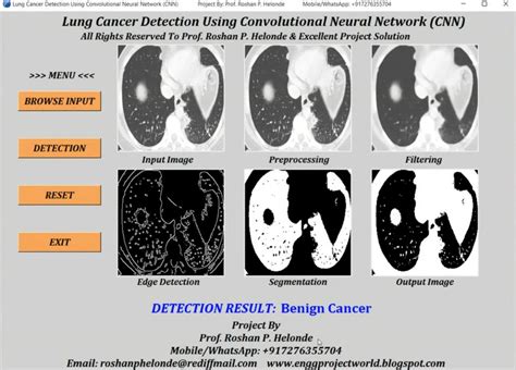 Lung Cancer Detection Using Convolutional Neural Network Cnn Python