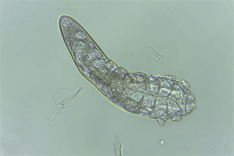 When their population booms, mites appear as brown stains or spots on walls especially in corners. What the tiny mites on our faces reveal about our history ...