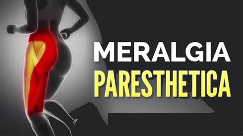 Meralgia Paresthetica Causes Symptoms And Treatment Images And Photos