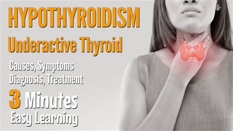 Hypothyroidism Underactive Thyroid Causes Symptoms Diagnosis