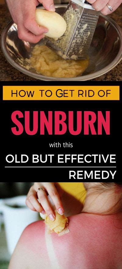 How To Get Rid Of Sunburn With This Old But Effective Remedy Get Rid