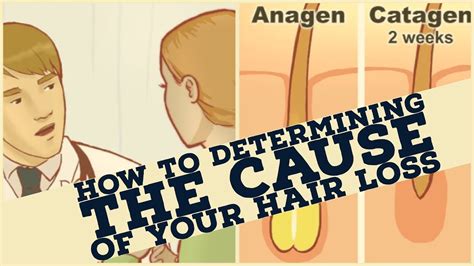 How To Determining The Cause Of Your Hair Loss Youtube