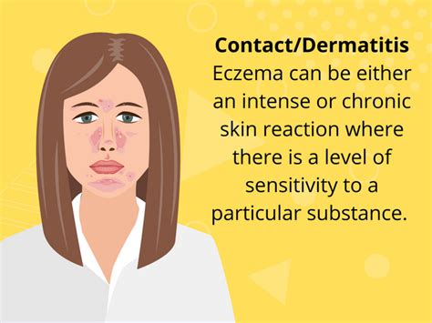 Remedies And Easy Recovery Methods For Eczema Condition Yoga Health
