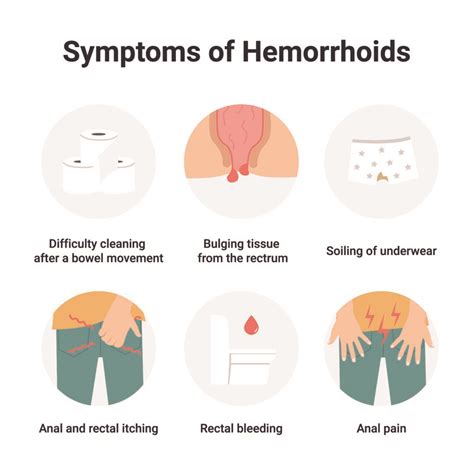 Piles Haemorrhoids Causes Symptoms Risk Factors And Treatment Ck Birla Hospital